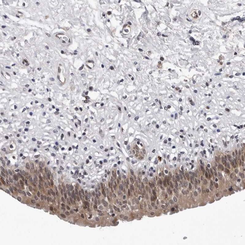 KIAA1614 Antibody - BSA Free Immunohistochemistry: KIAA1614 Antibody - BSA Free [NBP1-91038]