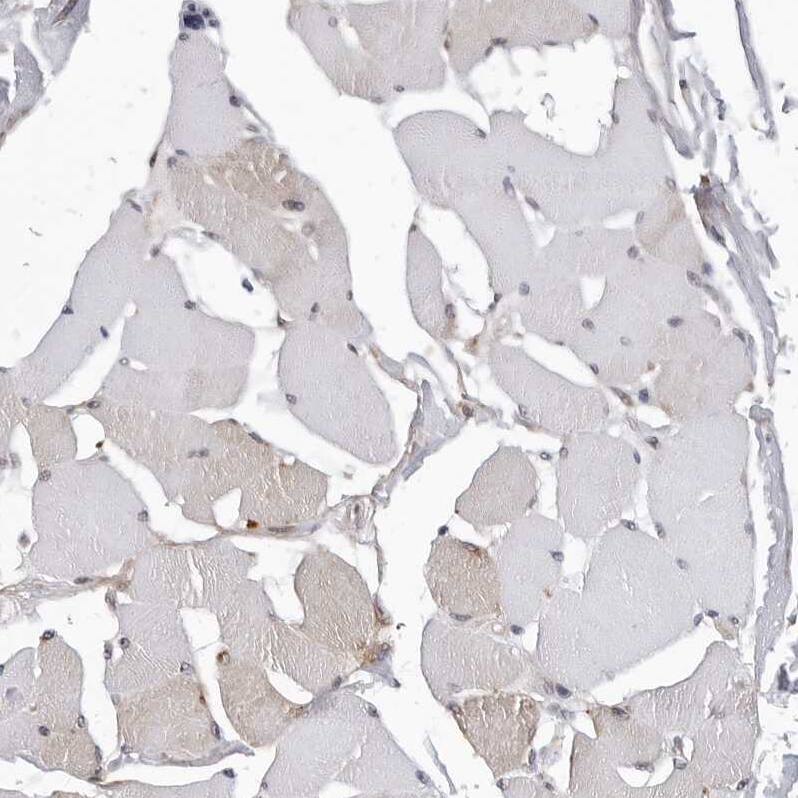 KIAA1614 Antibody - BSA Free Immunohistochemistry: KIAA1614 Antibody - BSA Free [NBP1-91038]