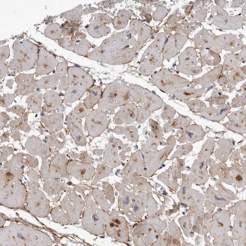 KIAA1614 Antibody - BSA Free Immunohistochemistry: KIAA1614 Antibody - BSA Free [NBP1-91038]