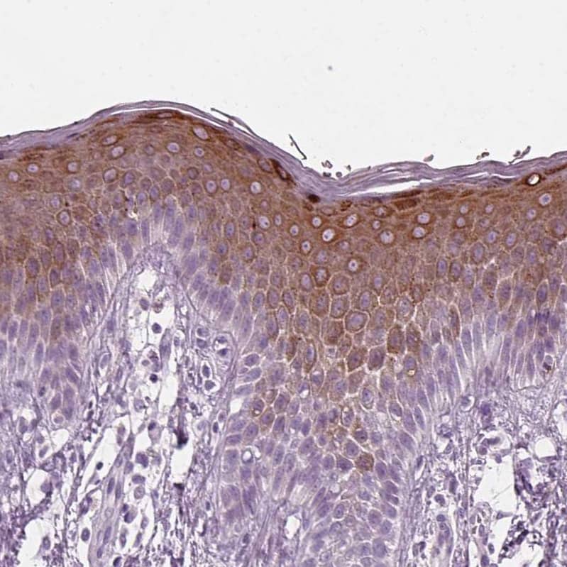 PRR9 Antibody - BSA Free Immunohistochemistry: PRR9 Antibody - BSA Free [NBP1-91041]
