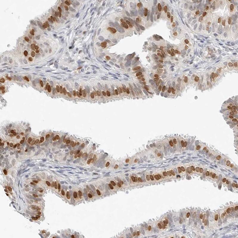 SPIDR Antibody - BSA Free Immunohistochemistry: SPIDR Antibody - BSA Free [NBP1-91044]