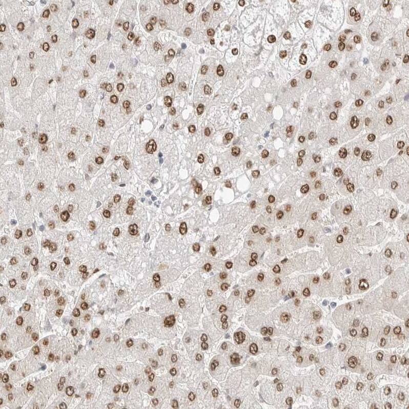 SPIDR Antibody - BSA Free Immunohistochemistry: SPIDR Antibody - BSA Free [NBP1-91044]