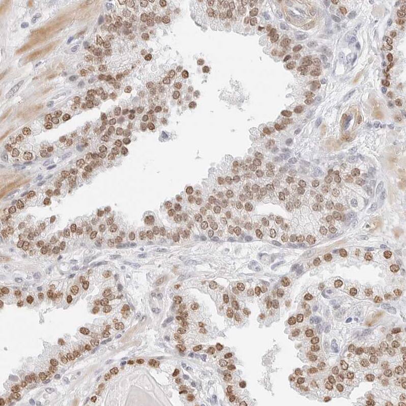 SPIDR Antibody - BSA Free Immunohistochemistry: SPIDR Antibody - BSA Free [NBP1-91044]