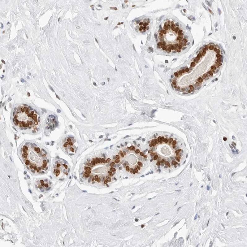 SPIDR Antibody - BSA Free Immunohistochemistry: SPIDR Antibody - BSA Free [NBP1-91044]
