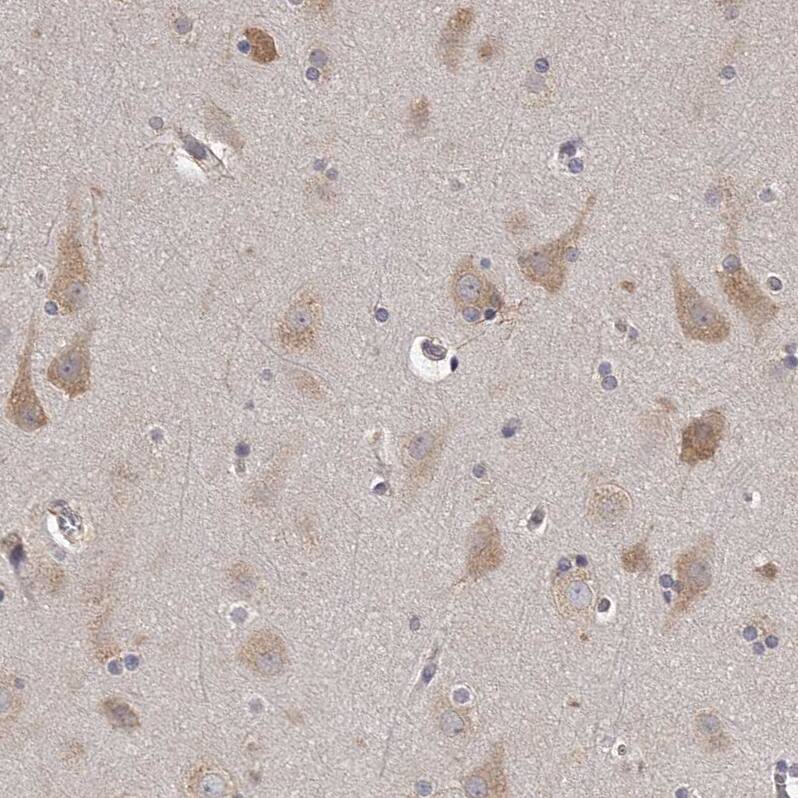 TNN Antibody - BSA Free Immunohistochemistry: TNN Antibody - BSA Free [NBP1-91048]