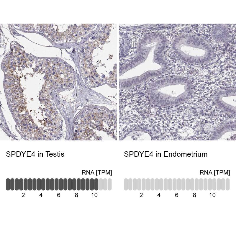 SPDYE4 Antibody - BSA Free Immunohistochemistry: SPDYE4 Antibody - BSA Free [NBP1-91055]