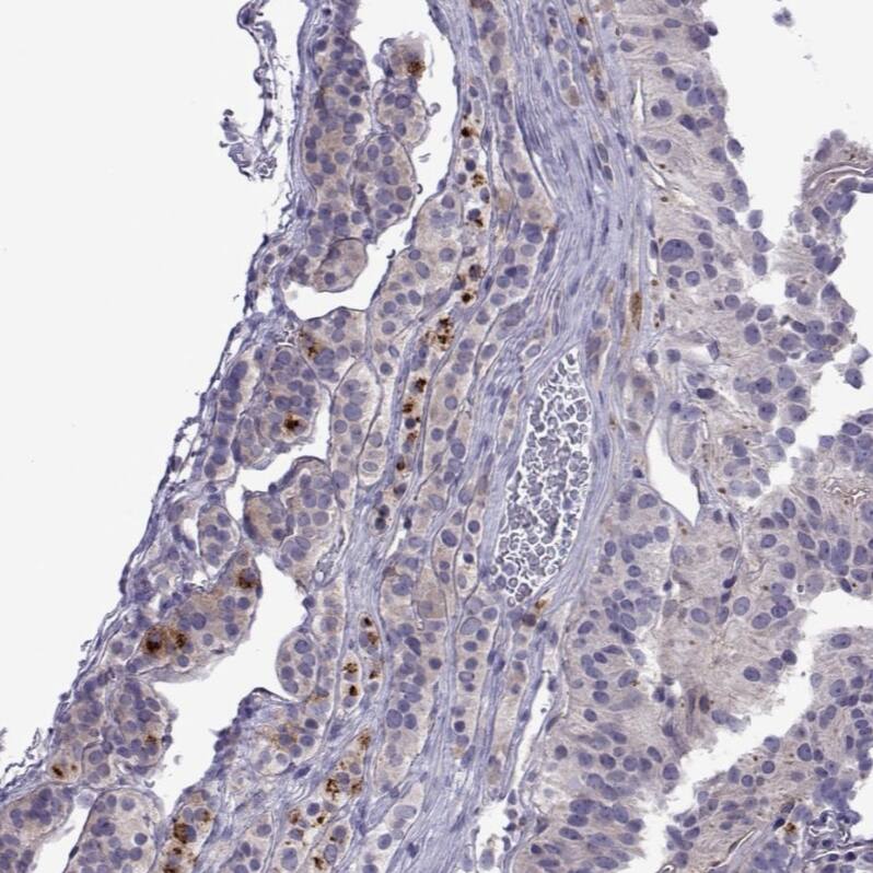 COL22A1 Antibody - BSA Free Immunohistochemistry: COL22A1 Antibody - BSA Free [NBP1-91056]
