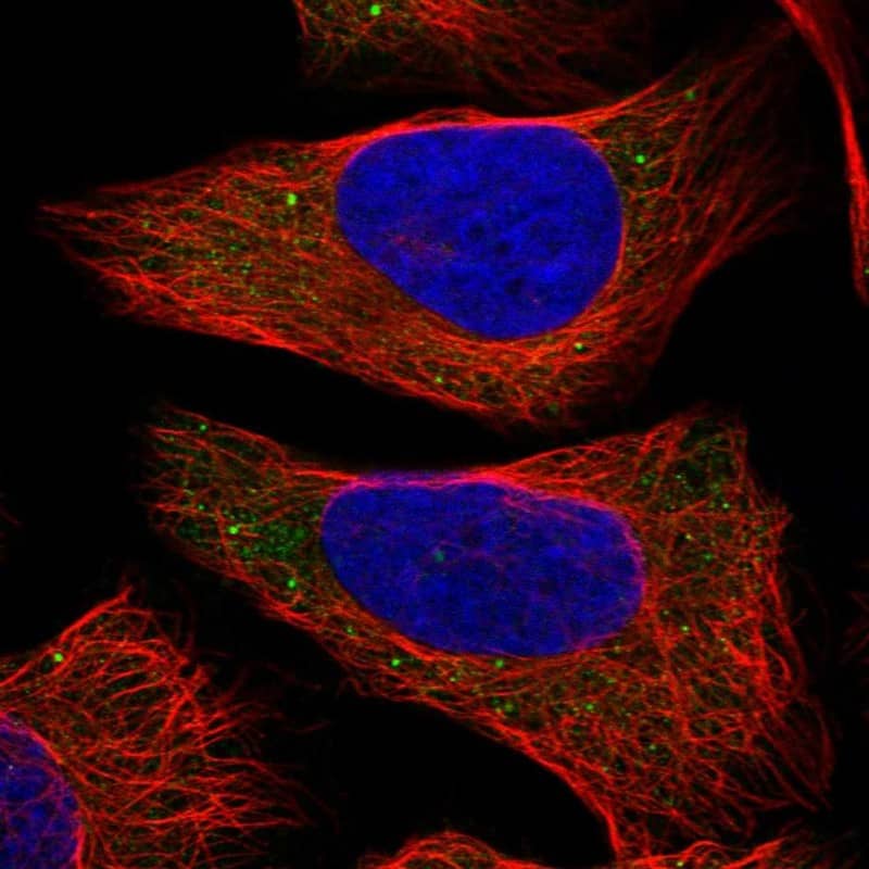 COL22A1 Antibody - BSA Free Immunocytochemistry/ Immunofluorescence: COL22A1 Antibody - BSA Free [NBP1-91056]