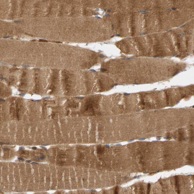 BAHCC1 Antibody - BSA Free Immunohistochemistry: BAHCC1 Antibody - BSA Free [NBP1-91067]