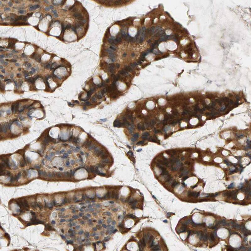 BAHCC1 Antibody - BSA Free Immunohistochemistry: BAHCC1 Antibody - BSA Free [NBP1-91067]