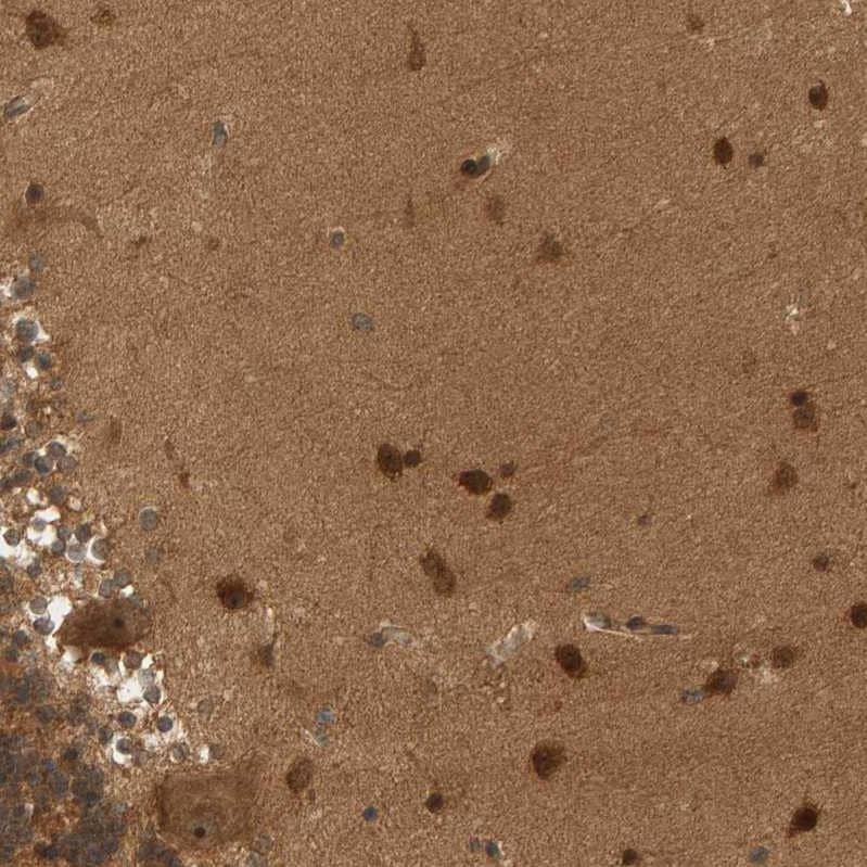 BAHCC1 Antibody - BSA Free Immunohistochemistry: BAHCC1 Antibody - BSA Free [NBP1-91067]