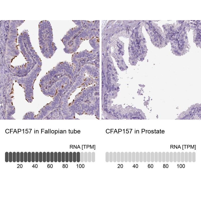 CFAP157 Antibody - BSA Free Immunohistochemistry: CFAP157 Antibody - BSA Free [NBP1-91072]