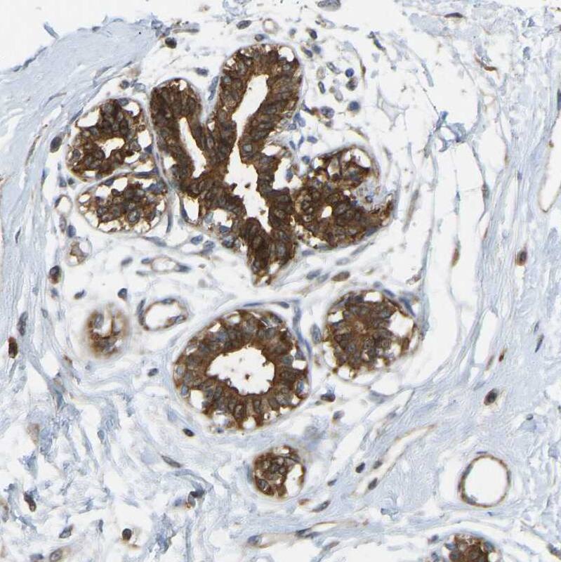 KIAA1671 Antibody - BSA Free Immunohistochemistry: KIAA1671 Antibody - BSA Free [NBP1-91085]