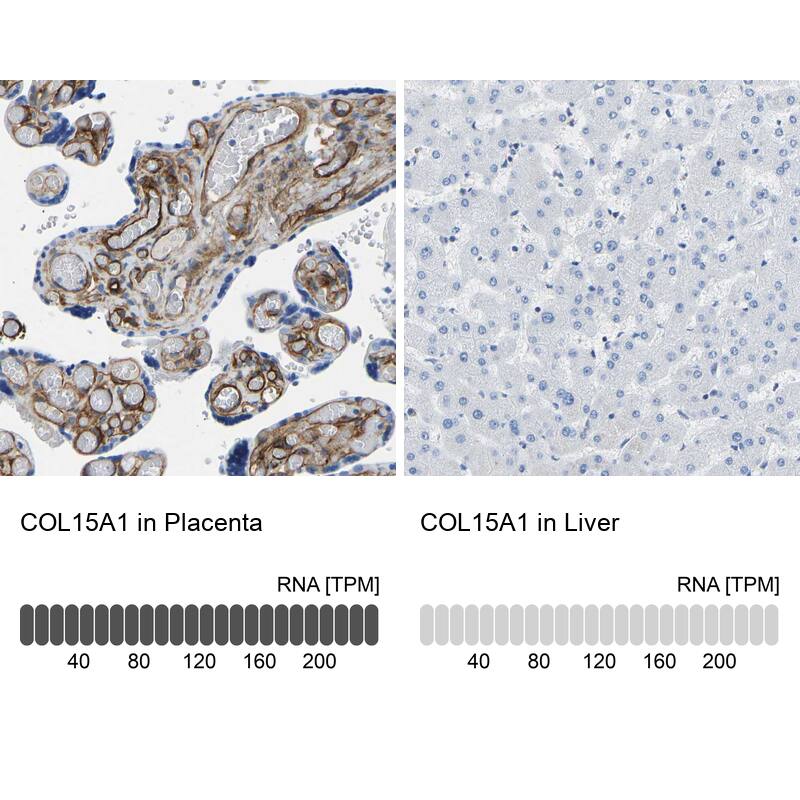 COL15A1 Antibody - BSA Free Immunohistochemistry-Paraffin: COL15A1 Antibody [NBP1-91087]