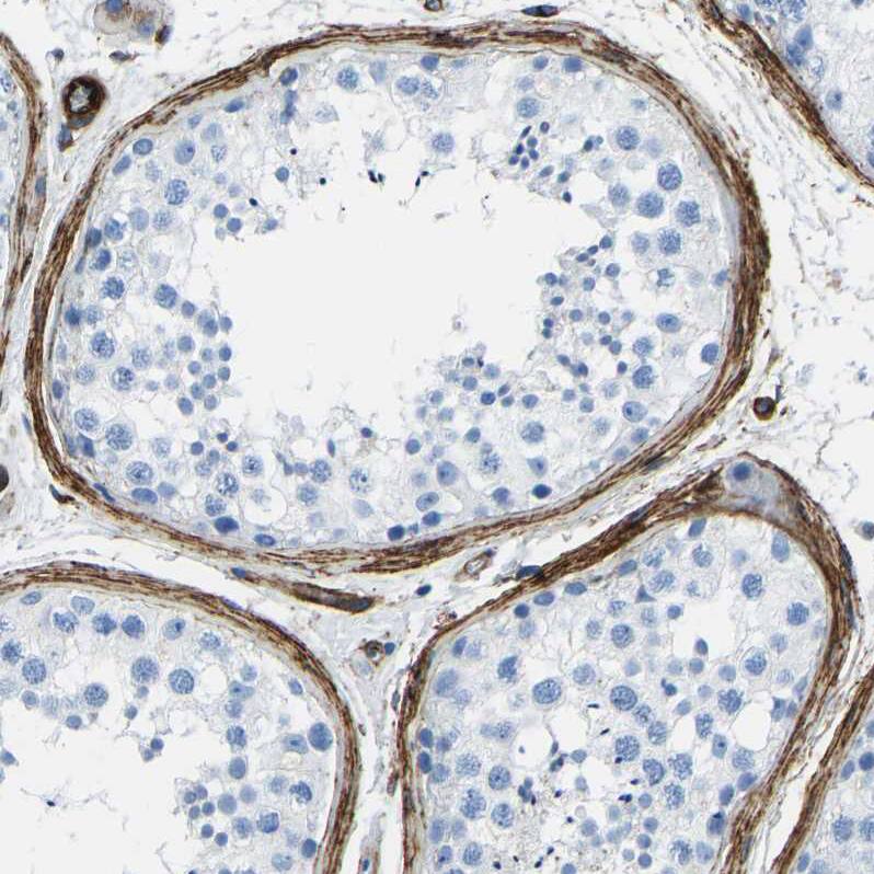 COL15A1 Antibody - BSA Free Immunohistochemistry-Paraffin: COL15A1 Antibody [NBP1-91087]