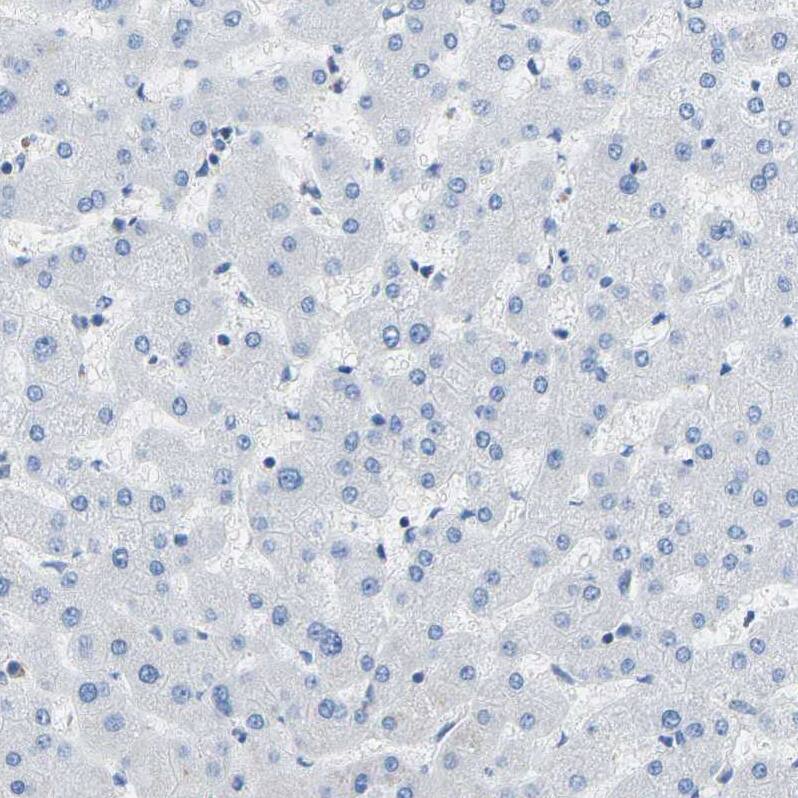 COL15A1 Antibody - BSA Free Immunohistochemistry-Paraffin: COL15A1 Antibody [NBP1-91087]