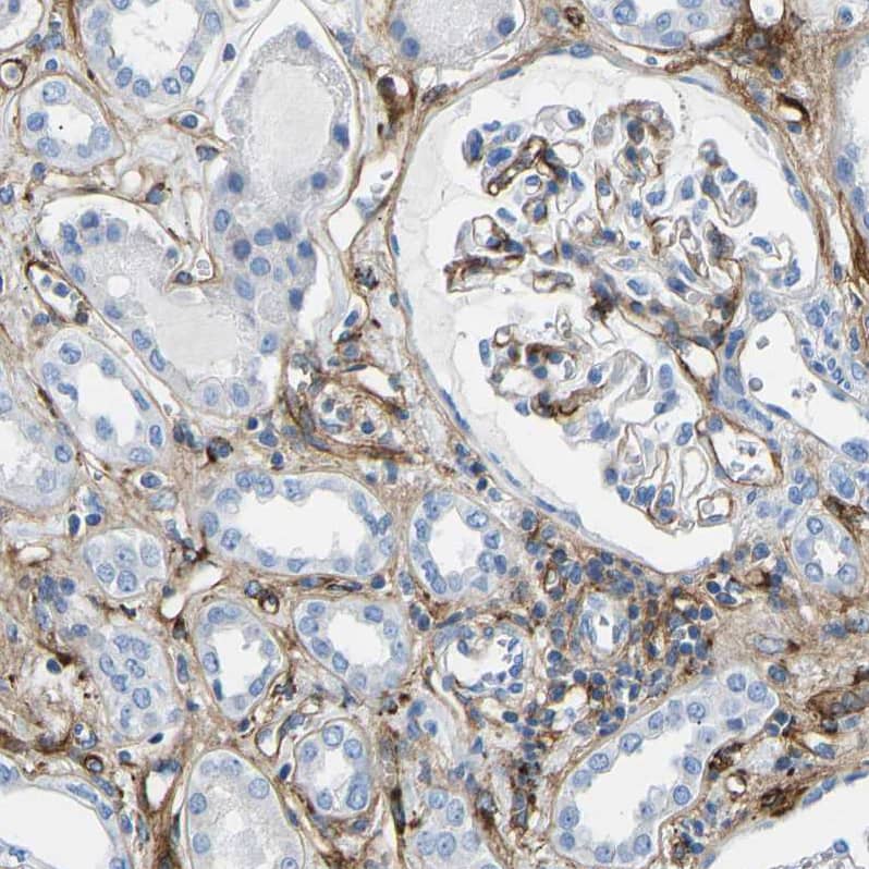 COL15A1 Antibody - BSA Free Immunohistochemistry: COL15A1 Antibody - BSA Free [NBP1-91087]