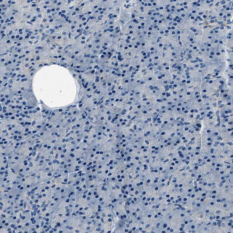 LRRC37B Antibody - BSA Free Immunohistochemistry: LRRC37B Antibody - BSA Free [NBP1-91094]