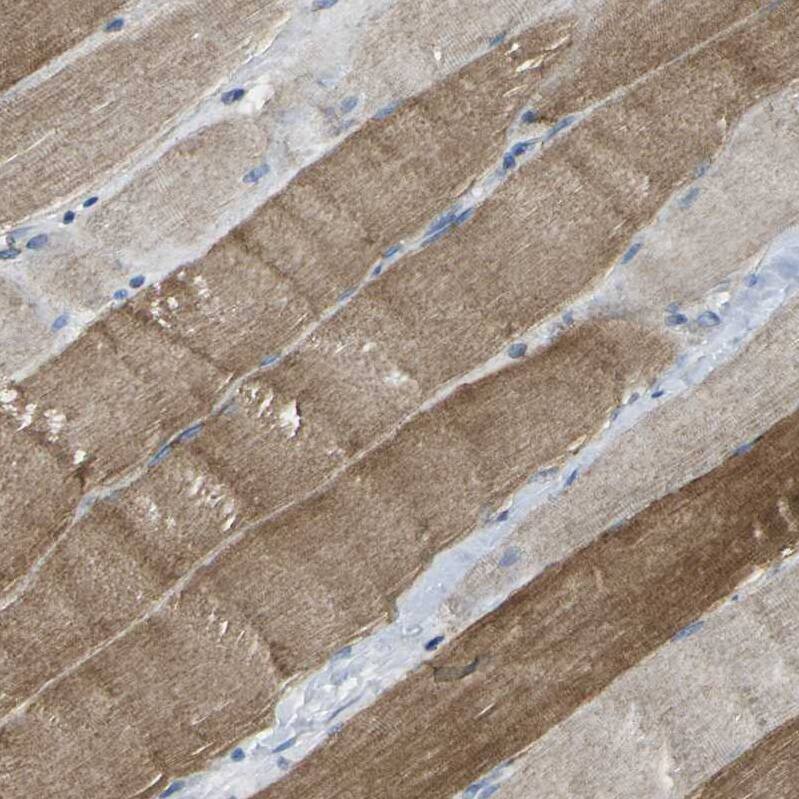 TMEM120B Antibody - BSA Free Immunohistochemistry: TMEM120B Antibody - BSA Free [NBP1-91101]