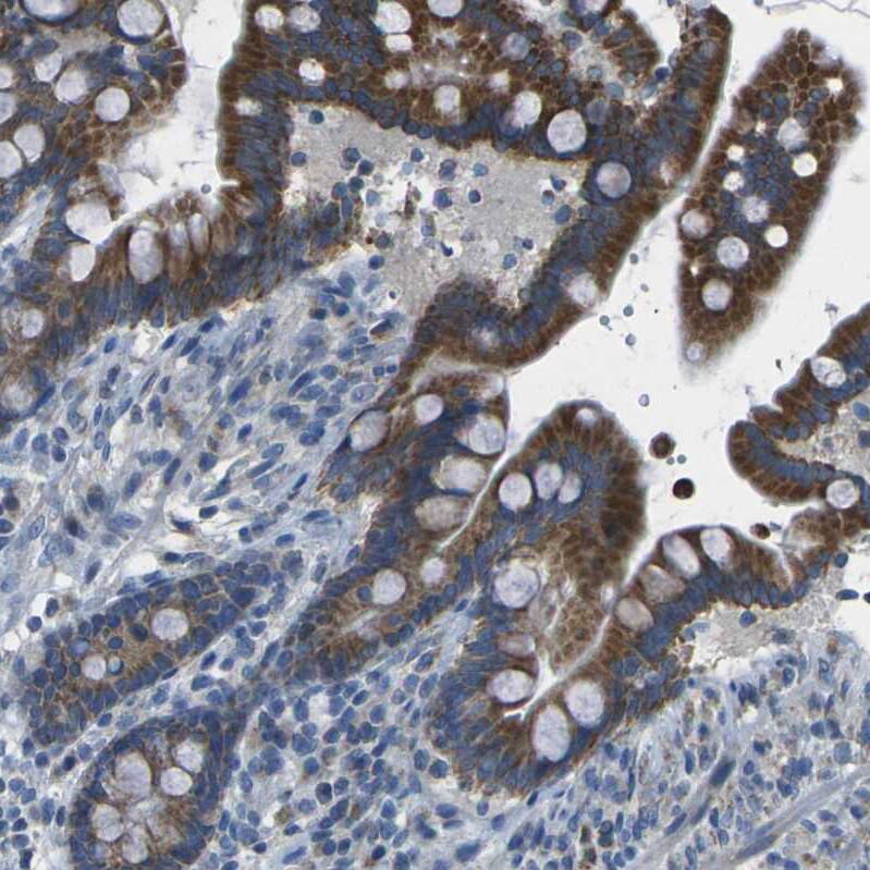 TMEM120B Antibody - BSA Free Immunohistochemistry: TMEM120B Antibody - BSA Free [NBP1-91101]