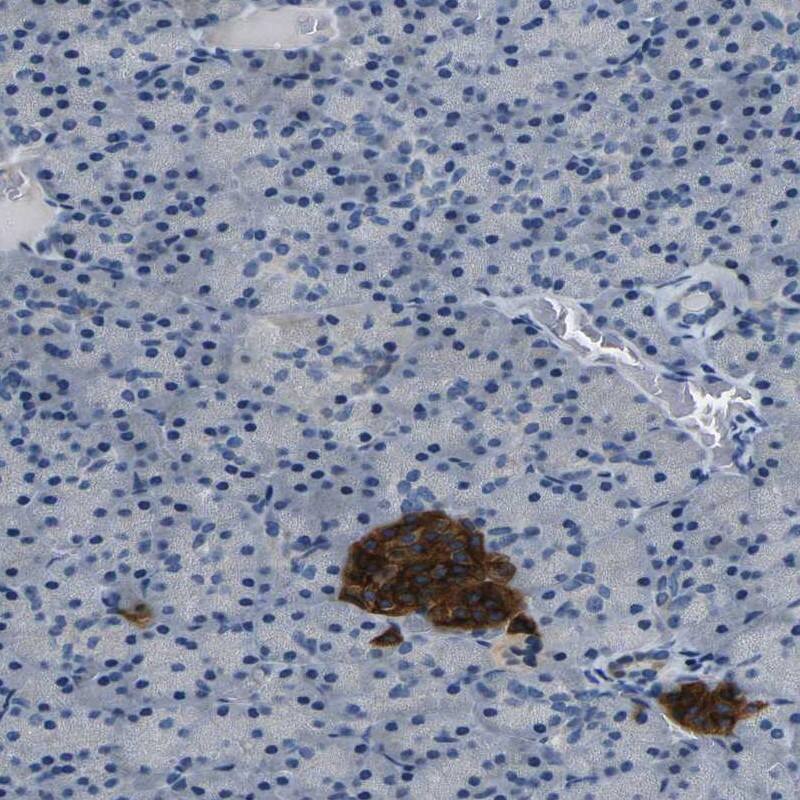 FAM159B Antibody - BSA Free Immunohistochemistry: FAM159B Antibody - BSA Free [NBP1-91103]