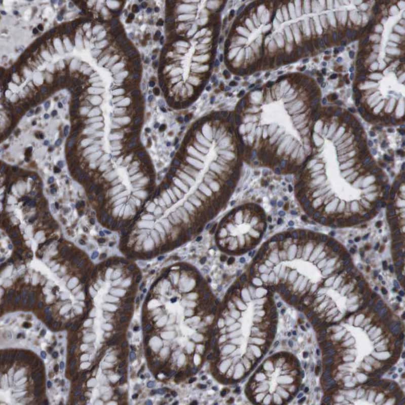 SNN Antibody - BSA Free Immunohistochemistry: SNN Antibody - BSA Free [NBP1-91104]