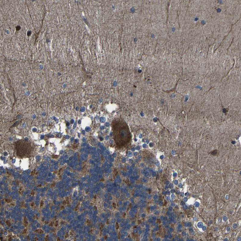SNN Antibody - BSA Free Immunohistochemistry: SNN Antibody - BSA Free [NBP1-91104]