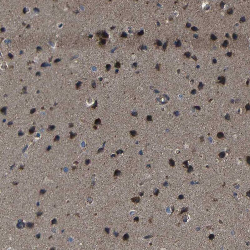 SNN Antibody - BSA Free Immunohistochemistry: SNN Antibody - BSA Free [NBP1-91104]