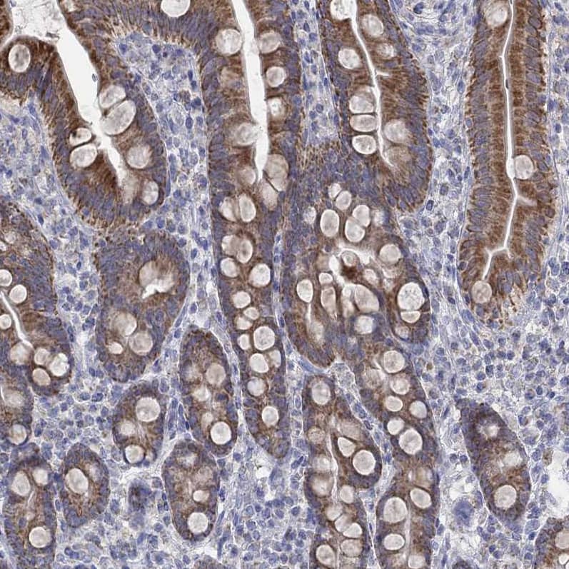 GLOD5 Antibody - BSA Free Immunohistochemistry: GLOD5 Antibody - BSA Free [NBP1-91105]
