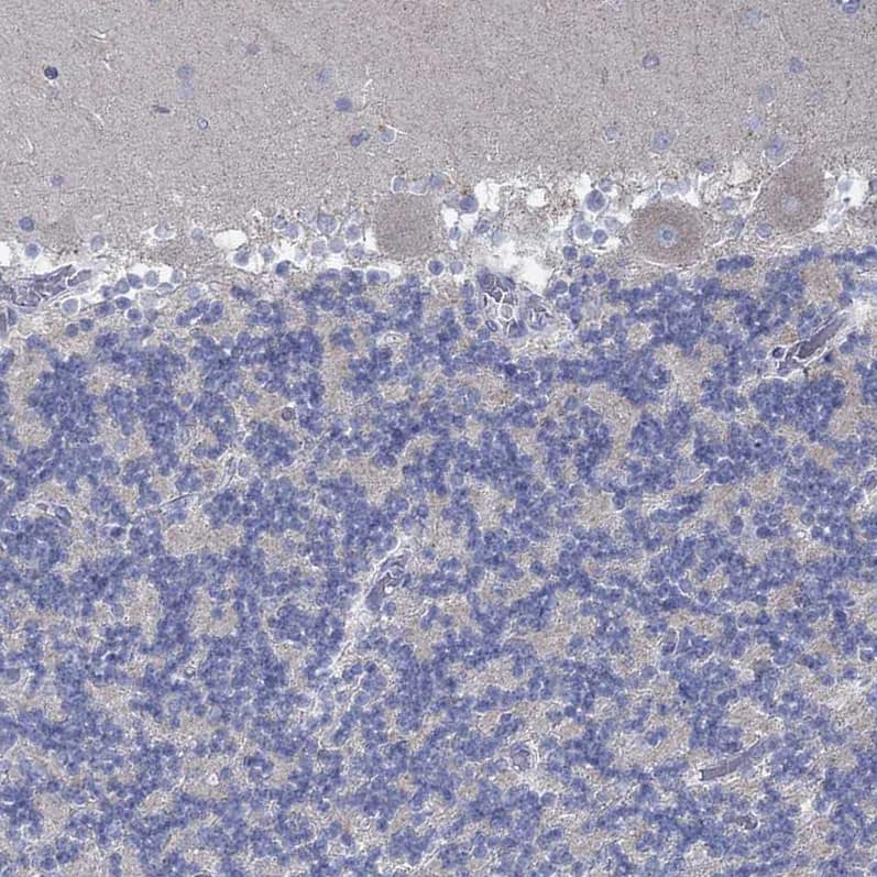 GLOD5 Antibody - BSA Free Immunohistochemistry: GLOD5 Antibody - BSA Free [NBP1-91105]