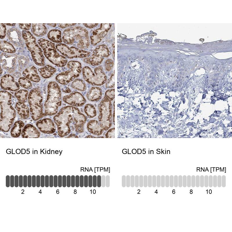 GLOD5 Antibody - BSA Free Immunohistochemistry: GLOD5 Antibody - BSA Free [NBP1-91105]