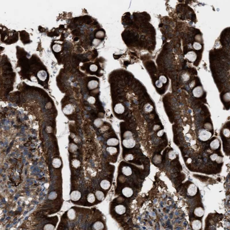 LRRC72 Antibody - BSA Free Immunohistochemistry: LRRC72 Antibody - BSA Free [NBP1-91116]