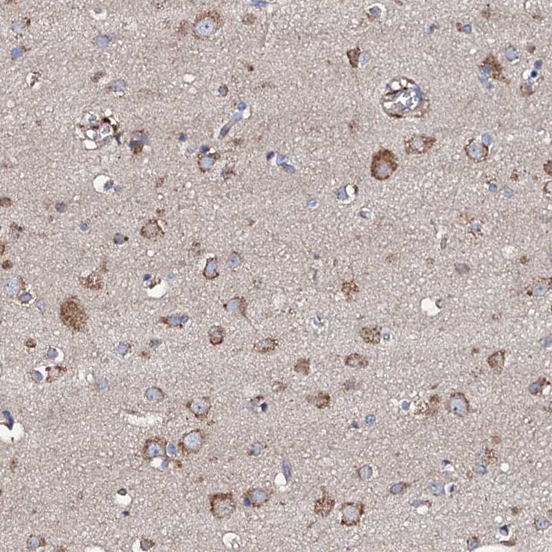 LIPT2 Antibody - BSA Free Immunohistochemistry: LIPT2 Antibody - BSA Free [NBP1-91135]