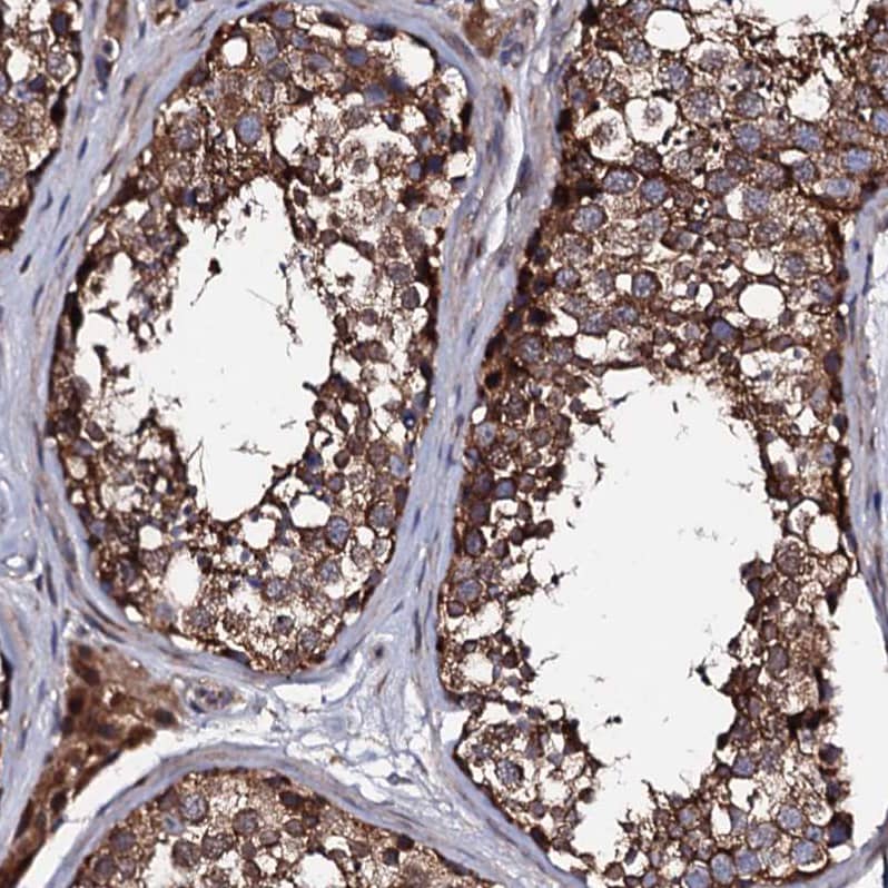 LIPT2 Antibody - BSA Free Immunohistochemistry: LIPT2 Antibody - BSA Free [NBP1-91135]
