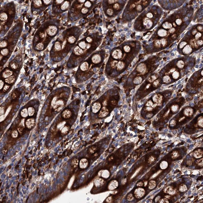 LIPT2 Antibody - BSA Free Immunohistochemistry: LIPT2 Antibody - BSA Free [NBP1-91135]