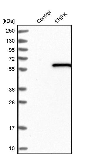 CARKL Antibody - BSA Free Western Blot: CARKL Antibody - BSA Free [NBP1-91151]