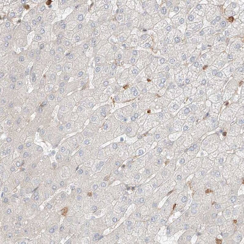 QN1 Antibody - BSA Free Immunohistochemistry: QN1 Antibody - BSA Free [NBP1-91158]
