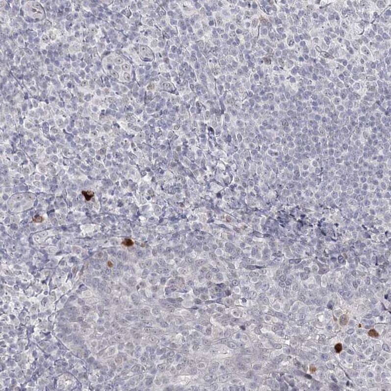 Ly-6G5C Antibody - BSA Free Immunohistochemistry-Paraffin: Ly-6G5C Antibody [NBP1-91160]