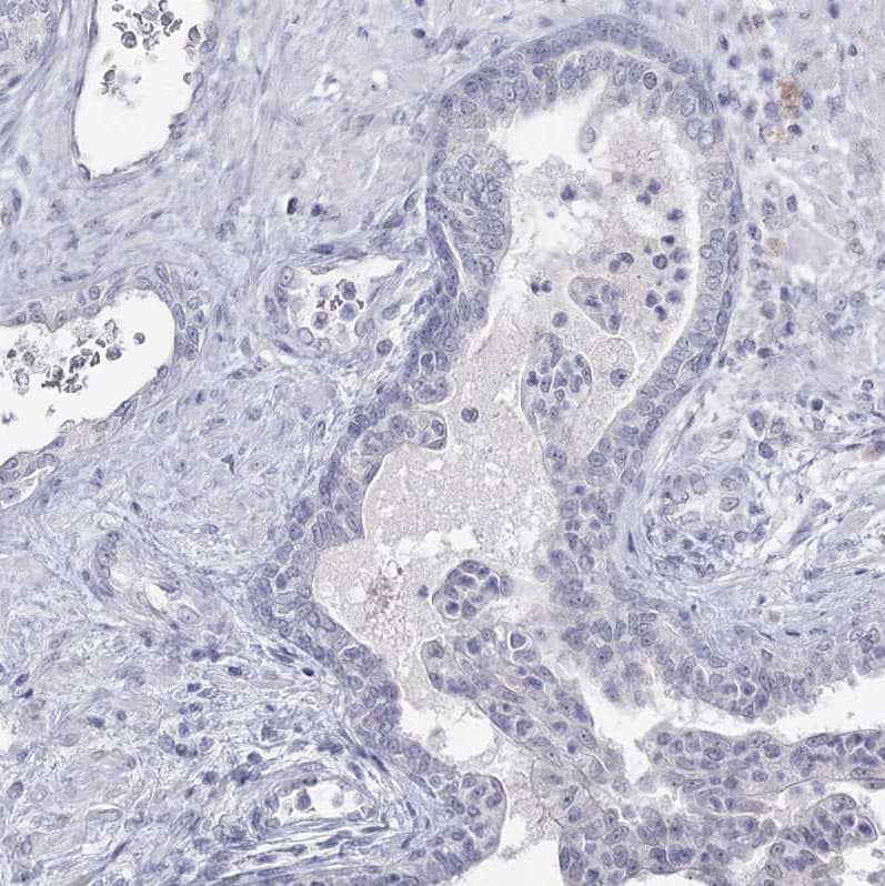 Ly-6G5C Antibody - BSA Free Immunohistochemistry-Paraffin: Ly-6G5C Antibody [NBP1-91160]