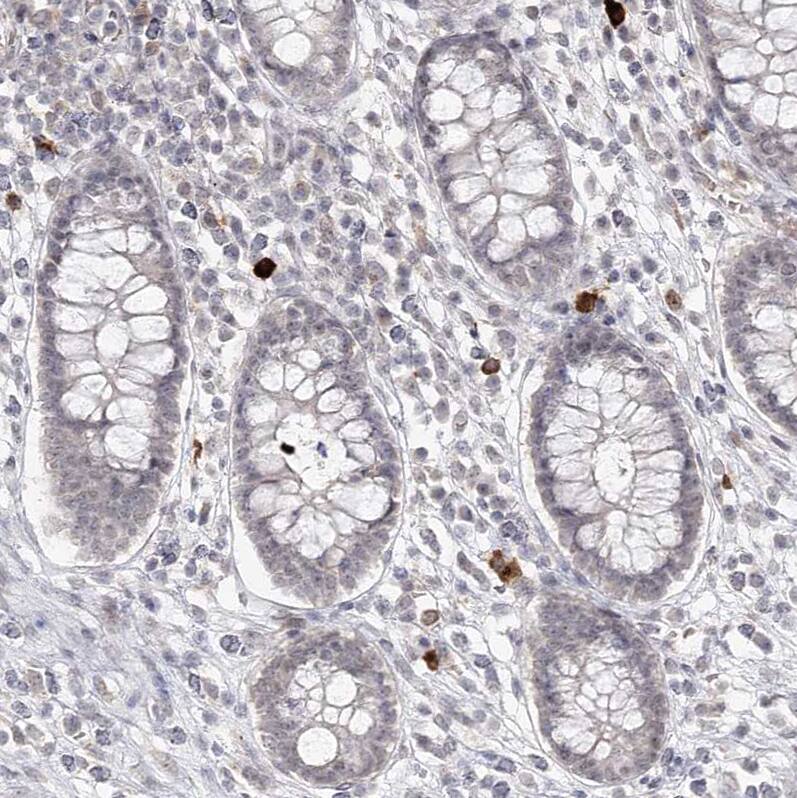 Ly-6G5C Antibody - BSA Free Immunohistochemistry-Paraffin: Ly-6G5C Antibody [NBP1-91160]