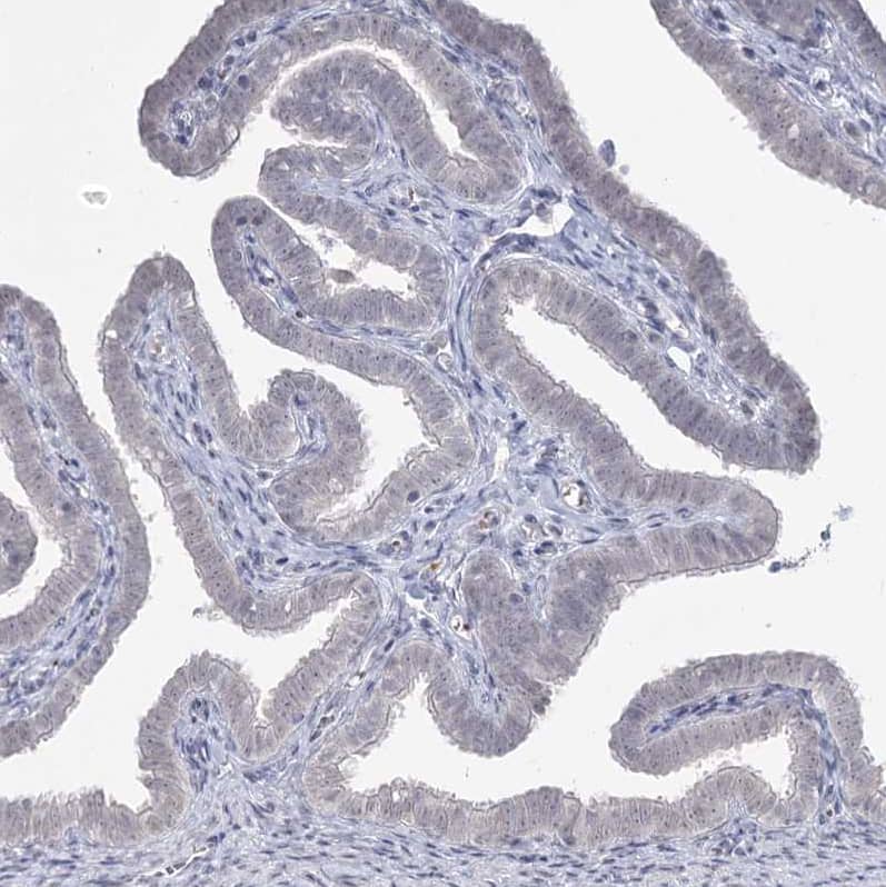 Ly-6G5C Antibody - BSA Free Immunohistochemistry-Paraffin: Ly-6G5C Antibody [NBP1-91160]