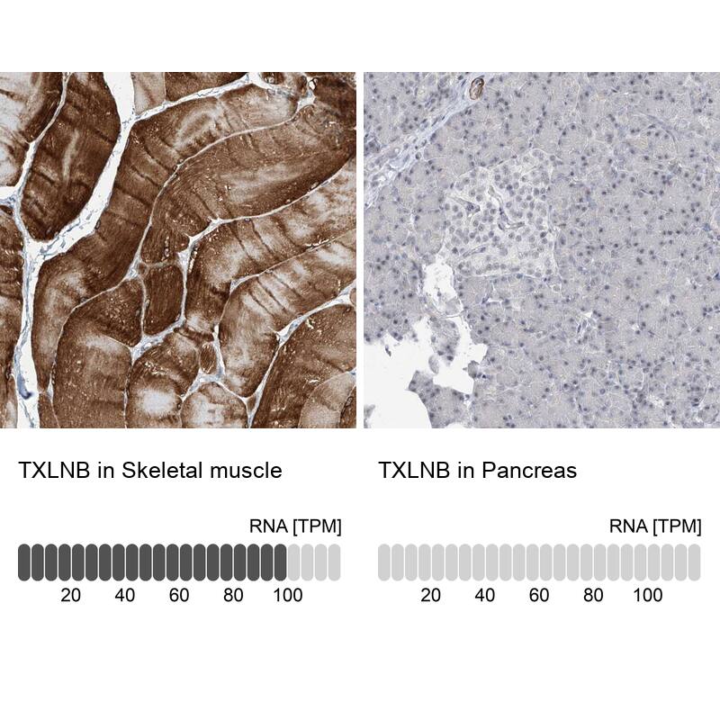 TXLNB Antibody - BSA Free Immunohistochemistry: TXLNB Antibody - BSA Free [NBP1-91161]