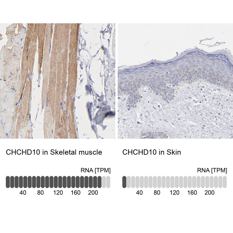 CHCHD10 Antibody - BSA Free Immunohistochemistry: CHCHD10 Antibody - BSA Free [NBP1-91169]