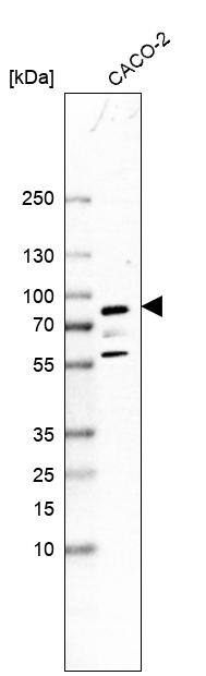 Glycogen synthase 2 Antibody - BSA Free Western Blot: Glycogen synthase 2 Antibody - BSA Free [NBP1-91191]