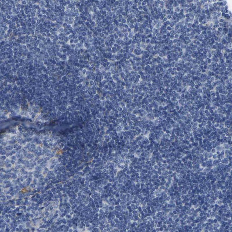 Collagen VI alpha 1 Antibody - BSA Free Immunohistochemistry: Collagen VI alpha 1 Antibody - BSA Free [NBP1-91195]