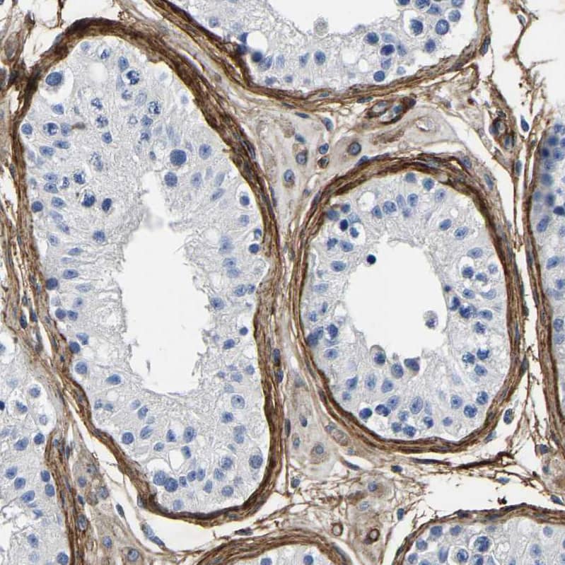 Collagen VI alpha 1 Antibody - BSA Free Immunohistochemistry: Collagen VI alpha 1 Antibody - BSA Free [NBP1-91195]