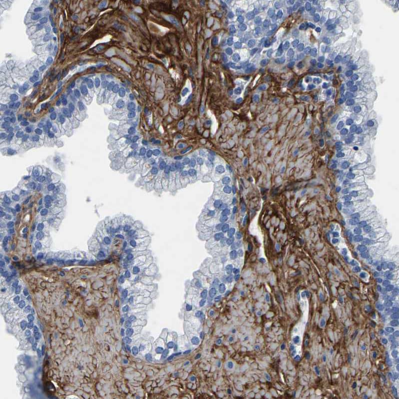 Collagen VI alpha 1 Antibody - BSA Free Immunohistochemistry: Collagen VI alpha 1 Antibody - BSA Free [NBP1-91195]
