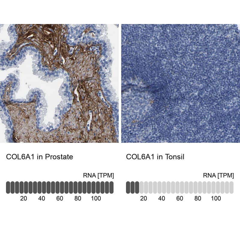 Collagen VI alpha 1 Antibody - BSA Free Immunohistochemistry: Collagen VI alpha 1 Antibody - BSA Free [NBP1-91195]