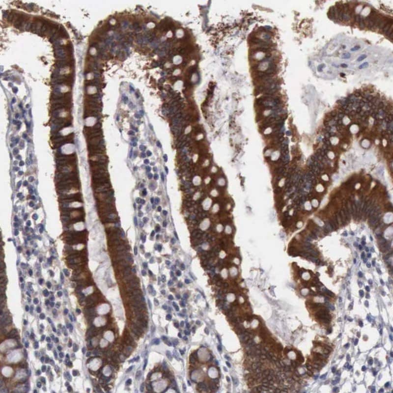 Amnionless/AMN Antibody - BSA Free Immunohistochemistry: Amnionless/AMN Antibody - BSA Free [NBP1-91203]