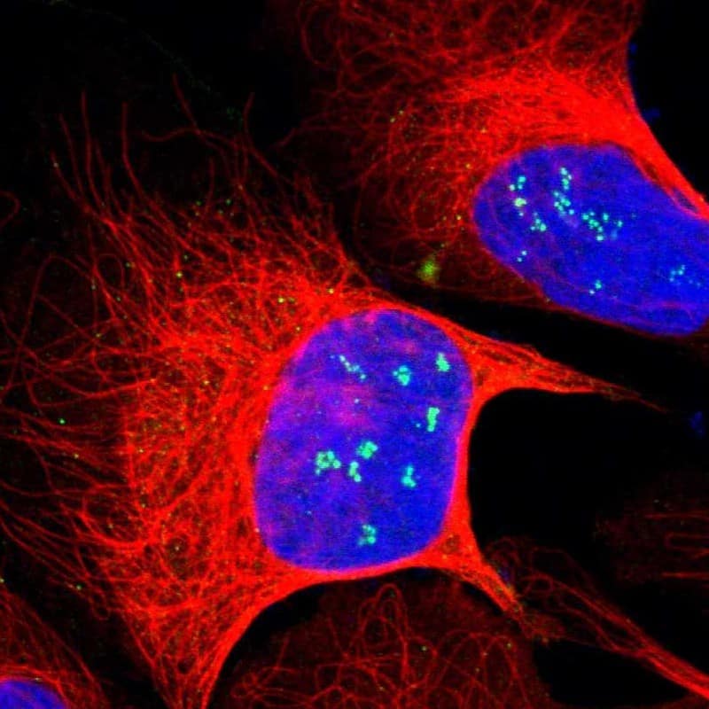 ZNF275 Antibody - BSA Free Immunocytochemistry/ Immunofluorescence: ZNF275 Antibody [NBP1-91205]